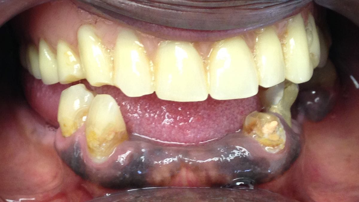 New York Family Dentistry Brooklyn