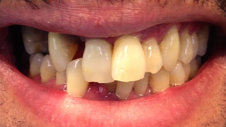 Before Extreme Makeover Benefits