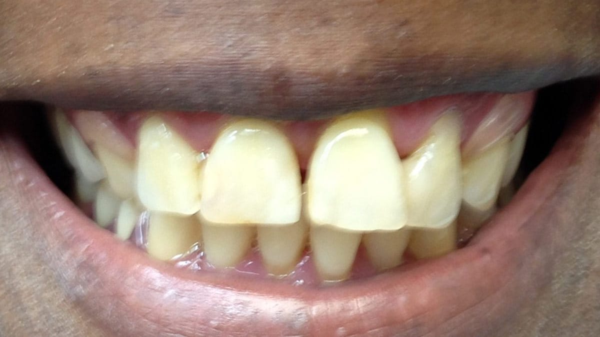 New York Family Dentistry Brooklyn