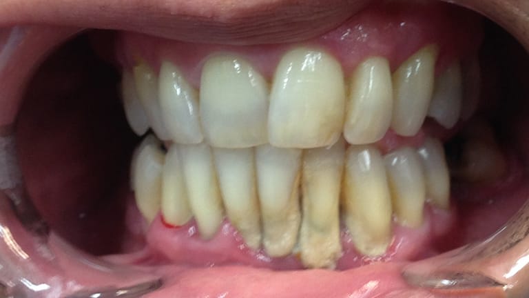 Before Extreme Makeover Benefits