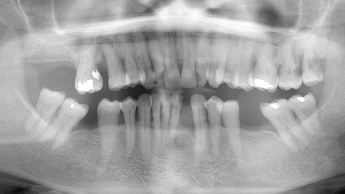 New York Family Dentistry Brooklyn