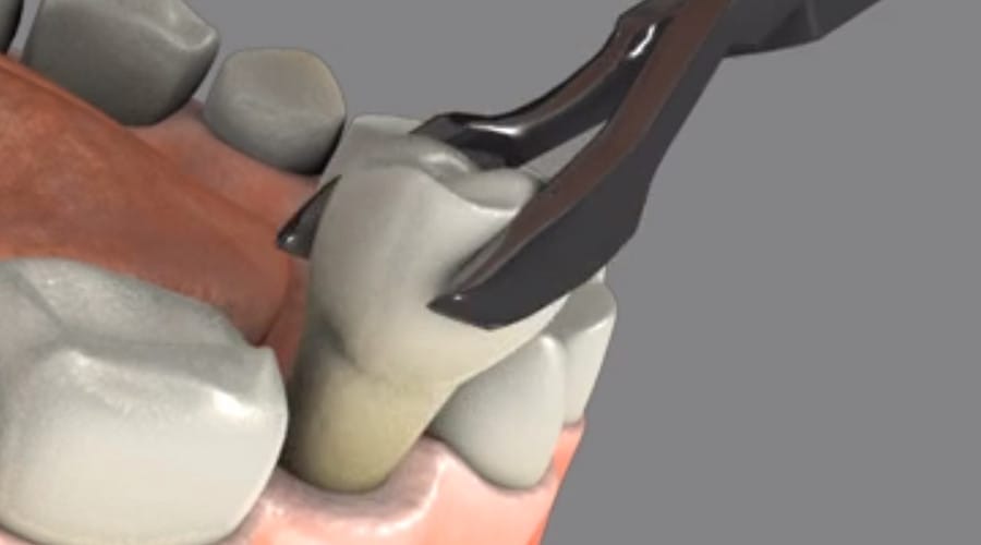 Restorative Dentistry Brooklyn, 4 Offices NY Family Dentistry